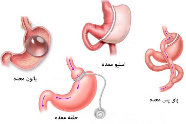 بهترین جراح لاغری 